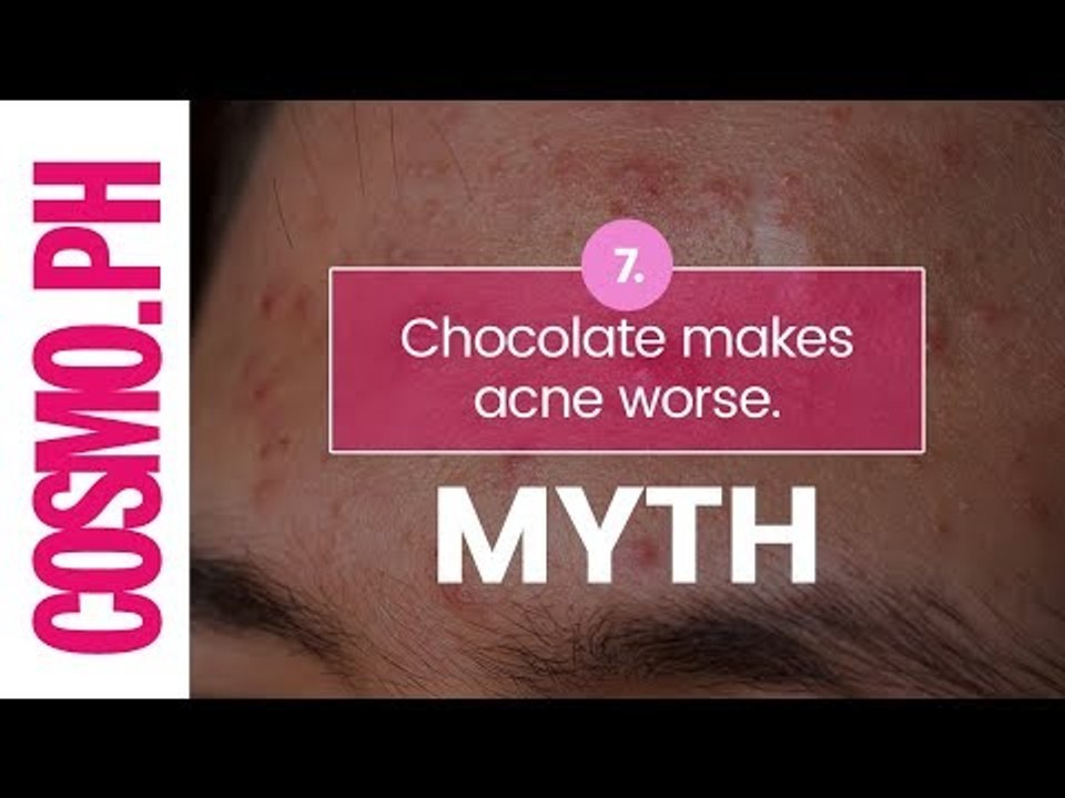 10 Acne Myths You Should Stop Believing