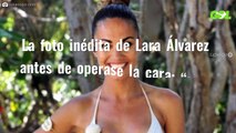 La foto inédita de Lara Álvarez antes de operase la cara: “¡¿En serio?!”