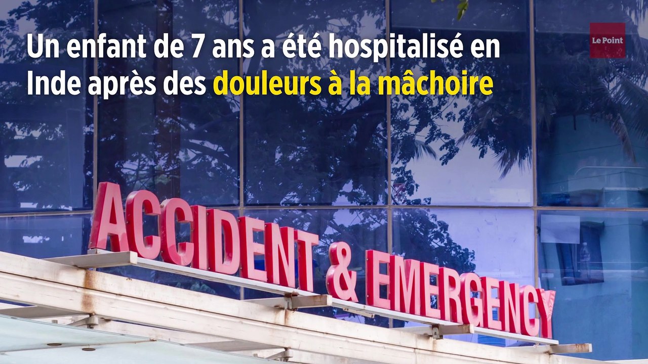 Inde : les médecins découvrent 526 dents dans la bouche d'un garçon