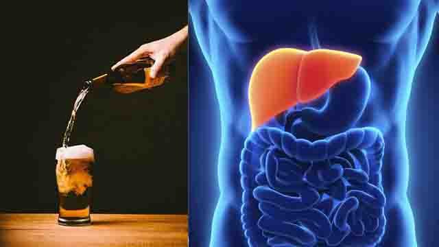 फैटी लिवर की सच्चाई (NASH) | Fatty Liver Secret | Boldsky