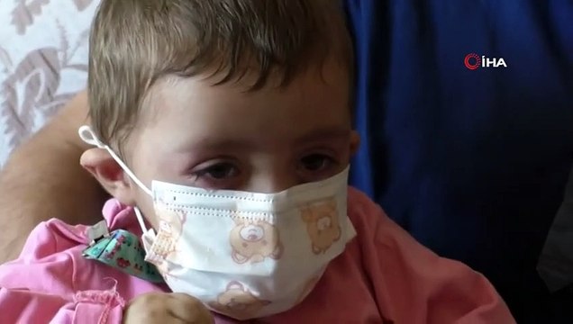 İlik Nakli Başarısız Olan Asel Bebek Tedavisine Devam Etmek İçin Yardım Bekliyor