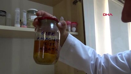 KAYSERİ Kurban Bayramı öncesi 'Kist hidatik' uyarısı