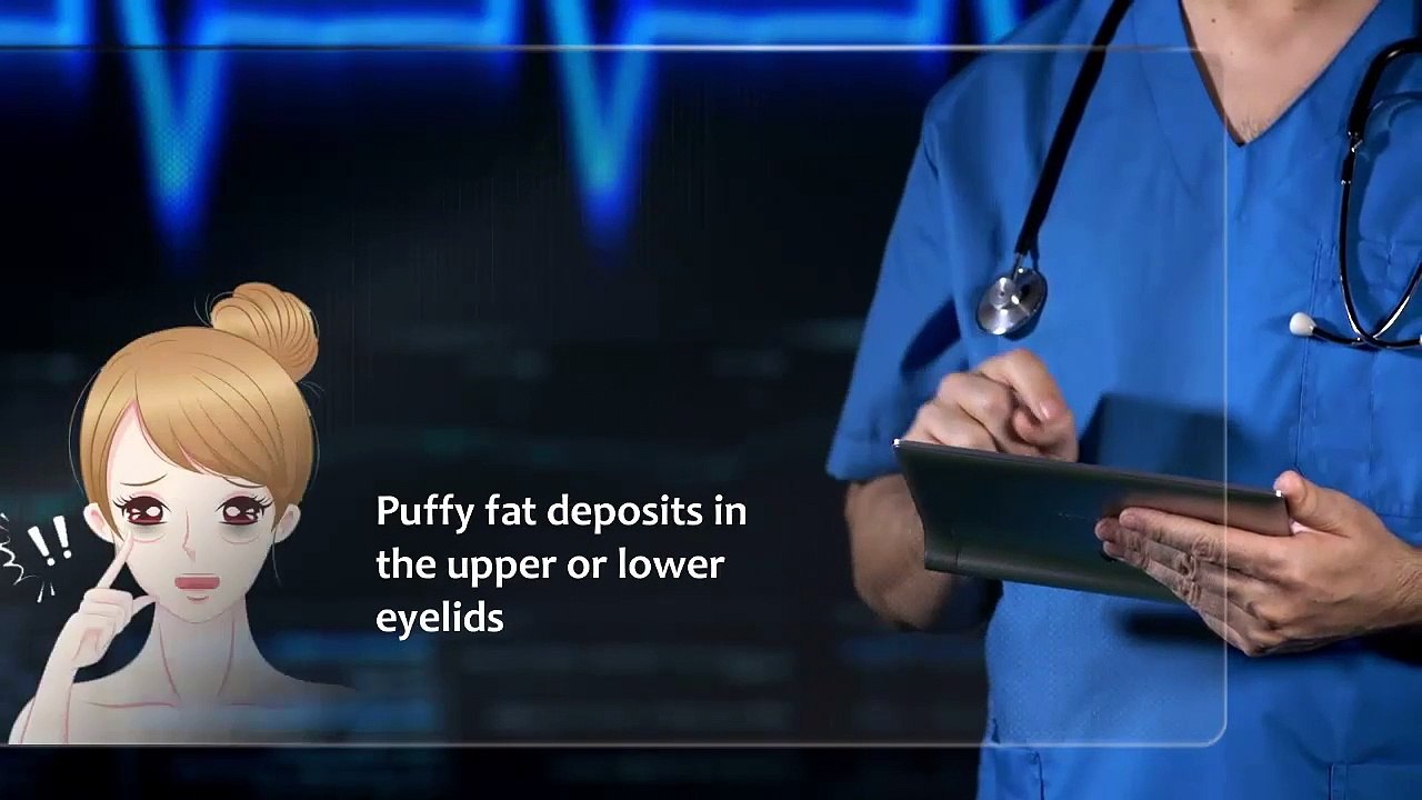 Blepharoplasty - A Plastic Surgery For Correcting Eyelids Defects