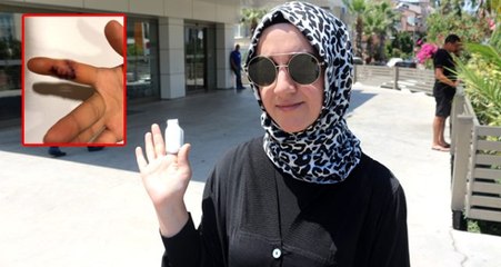 Ultra lüks otelde skandal! İhmal sonucu az daha parmağından oluyordu