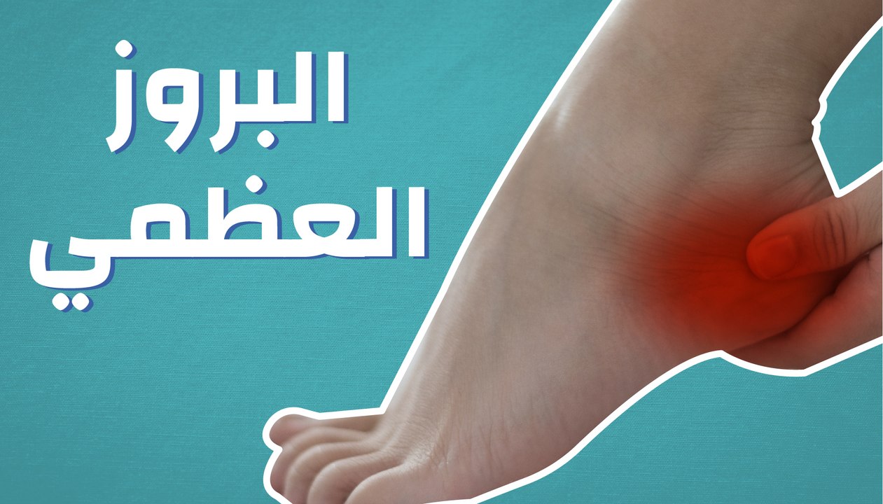 البروز العظمي