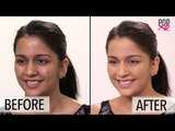 How To Do Makeup To Cover Acne | Makeup Tutorial - POPxo
