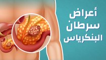 أعراض سرطان البنكرياس