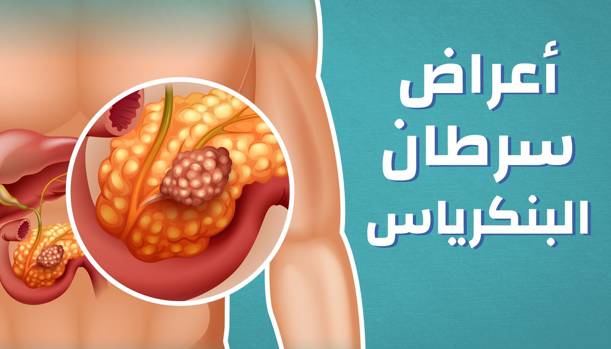 أعراض سرطان البنكرياس