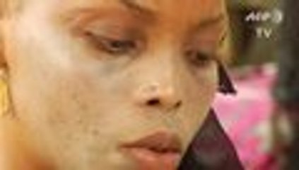 Aclarar la piel a toda costa