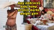 #Motherhood: Amy embraces baby bump, stretch marks, weight gain
