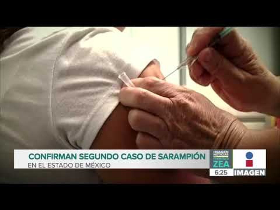 Confirman segundo caso de sarampión en el Estado de México | Noticias con Francisco Zea