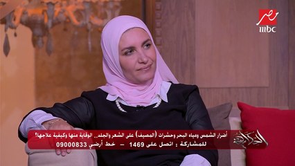 أسباب ظهور النمش وطرق علاجه