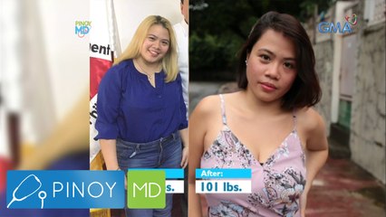 Pinoy MD: Dalaga, nagsilbing fitspiration sa kabila ng PCOS!