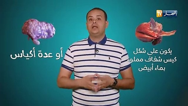 صحة MAG: هل الكيس المائي يشكل خطرا على صحة المستهلك