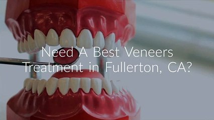 Gentle Touch Dentistry : Best Veneers Treatment in Fullerton, CA