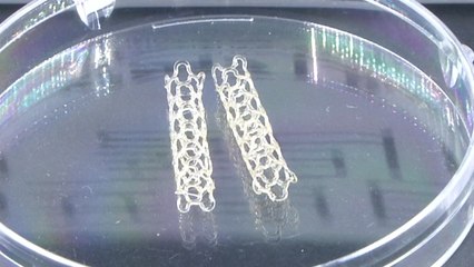바이오 3D프린팅 기술로 '생분해성 스텐트' 최초 개발 / YTN