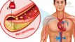 6 FOODS THAT WILL CLEAN YOUR ARTERIES FROM BAD CHOLESTEROL