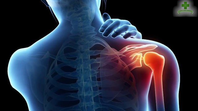 How To Cure Joint Pain And Arthritis Fast