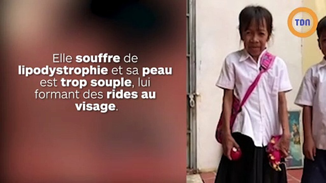 Une écolière de 10 ans ressemble à une femme de 60 ans et subit les moqueries au quotidien !