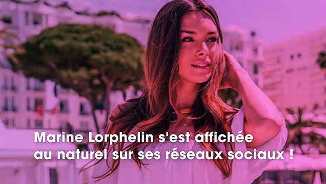 Marine Lorphelin : sans maquillage, elle montre les imperfections qu'elle veut masquer