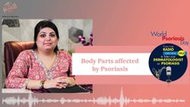 सोरायसिस के होने का कारण और इलाज | What is Psoriasis, Causes, Treatment Explain by Dr. Nivedita Dadu