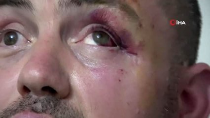 Gaziyi dövüp serbest kalan 3 saldırgan tutuklandı