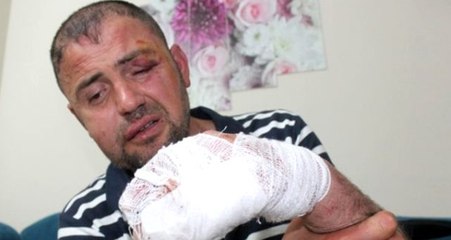 Ayağını sehpaya uzatan yüzde 92 engelli gaziyi darbeden 3 kişi tutuklandı