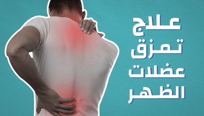 علاج تمزق عضلات الظهر
