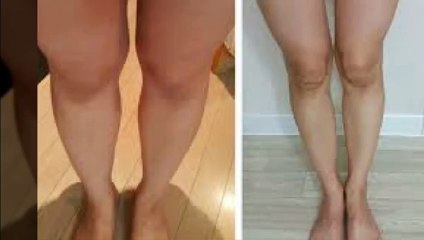 춘천출장안마 -후불100%ョOiOV8264V5054｛카톡JJ35｝ 춘천전지역출장안마 춘천오피걸 춘천출장마사지 춘천출장안마 춘천출장마사지 춘천출장콜걸샵안마 춘천출장아로마₭ч℃