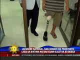 Japanese national donates prosthetic legs for Raissa