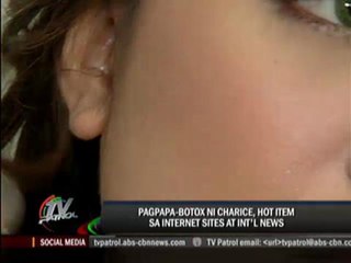 Netizens react to Charice’s Botox treatment