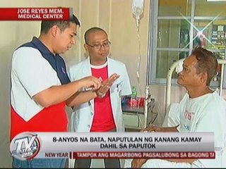 Man loses eyesight due to ‘Goodbye, Philippines’