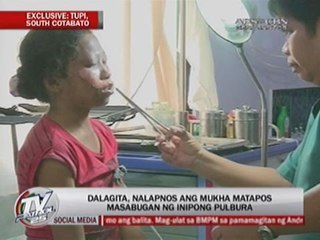 Teener stands to lose hand after picking up firecracker in Cotabato