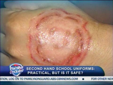 pamilyaonguard-SECONDHAND UNIFORMS MAY INCREASE RISK OF SKIN DISEASES