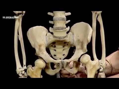 Cuál es el costo de sufrir osteoporosis en México