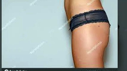 평창출장안마 -후불100%ョOiOV8264V5054｛카톡JJ35｝ 평창전지역출장안마 평창오피걸 평창출장마사지 평창출장안마 평창출장마사지 평창출장콜걸샵안마 평창출장아로마₭ч℃