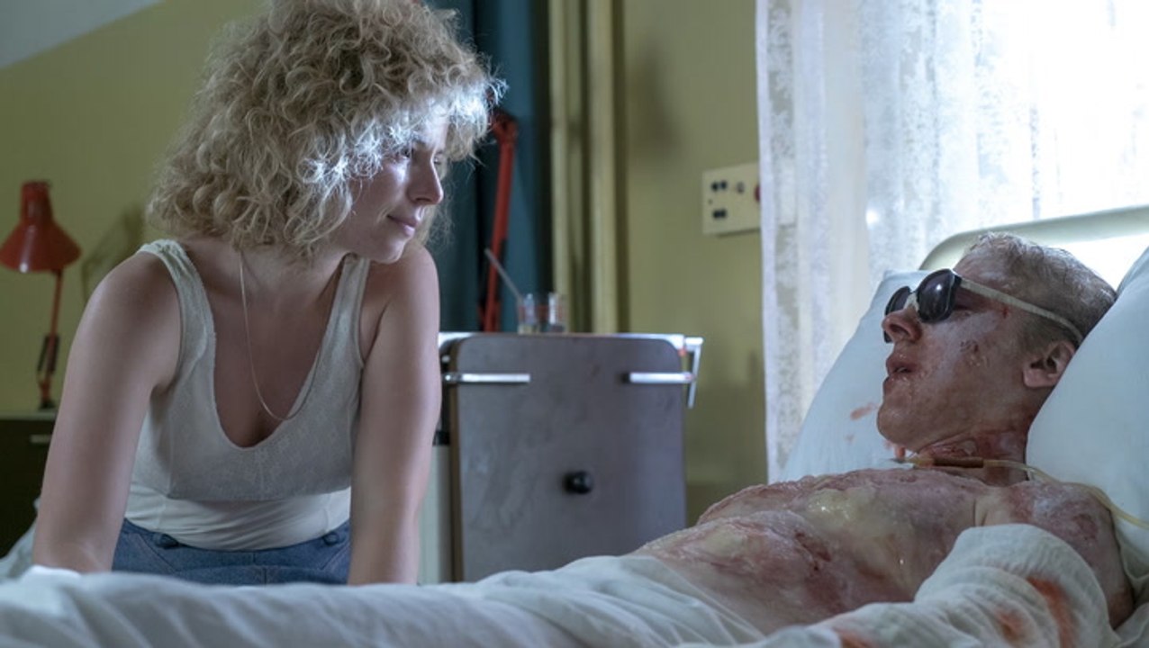 How HBO's 'Chernobyl' Recreated the Horrific Radiation Burns - Variety ...