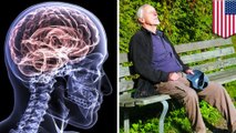 Studi menyatakan sering tidur siang pertanda Alzheimer - TomoNews