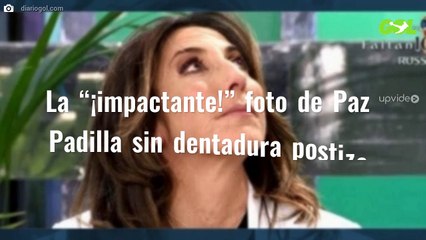La “¡impactante!” foto de Paz Padilla sin dentadura postiza
