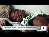 OMS detecta más de 364 mil casos de sarampión en el mundo | Noticias con Francisco Zea