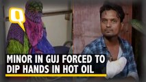 Minor Forced to Dip Her Hands in Boiling Oil to Prove Not Having an Affair in Gujarat