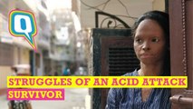The Many Hurdles in the Life of Acid Attack Survivor Laxmi