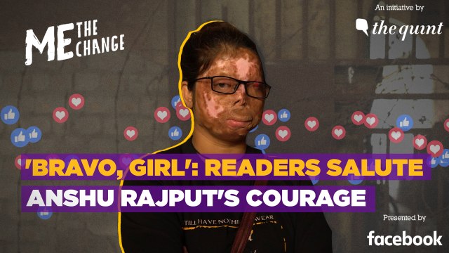 ‘Bravo, Girl’: Readers Salute Acid Attack Survivor Anshu Rajput's Courage