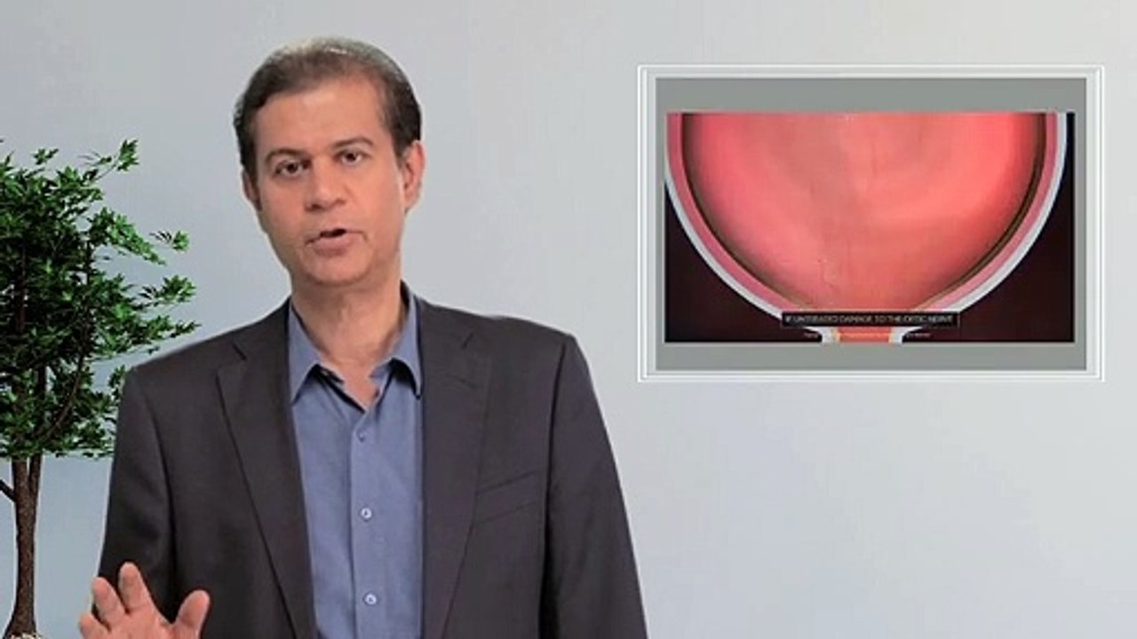 Understanding Glaucoma with Dr. Niteen Dedhia ( Best Eye Surgeon In Mumbai )