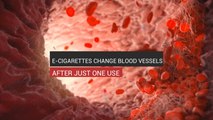 E-Cigs Change Blood Vessels After One Use