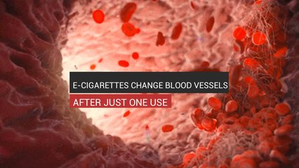 E-Cigs Change Blood Vessels After One Use