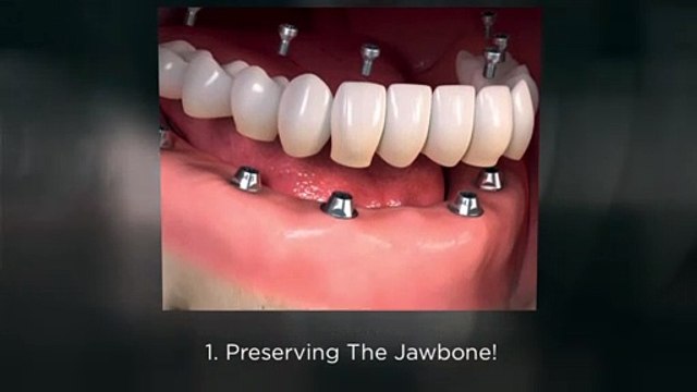 Teeth Whitening To Obtain A Perfect Smile