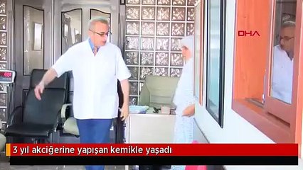 3 yıl akciğerine yapışan kemikle yaşadı