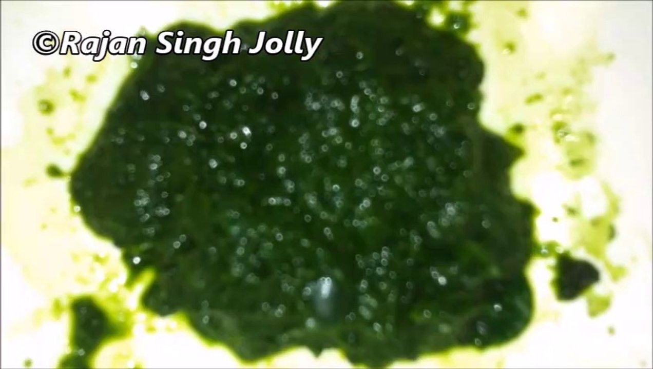 Home Remedy For Pimples, Acne And Skin Blemishes