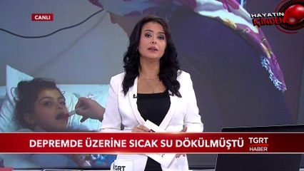 Depremde Üzerine Sıcak Su Dökülen Hira Nur Yardım Bekliyor